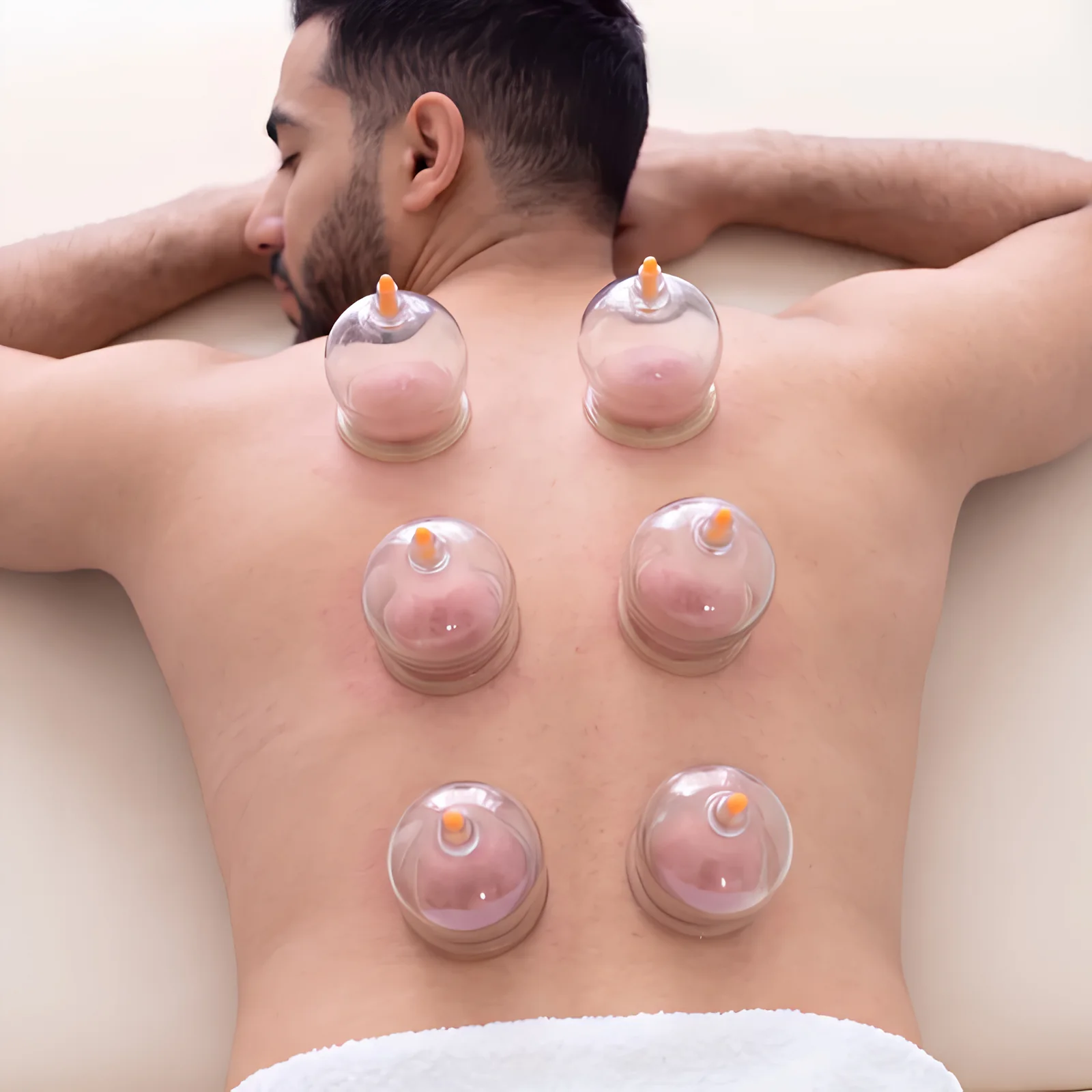Cupping therapy