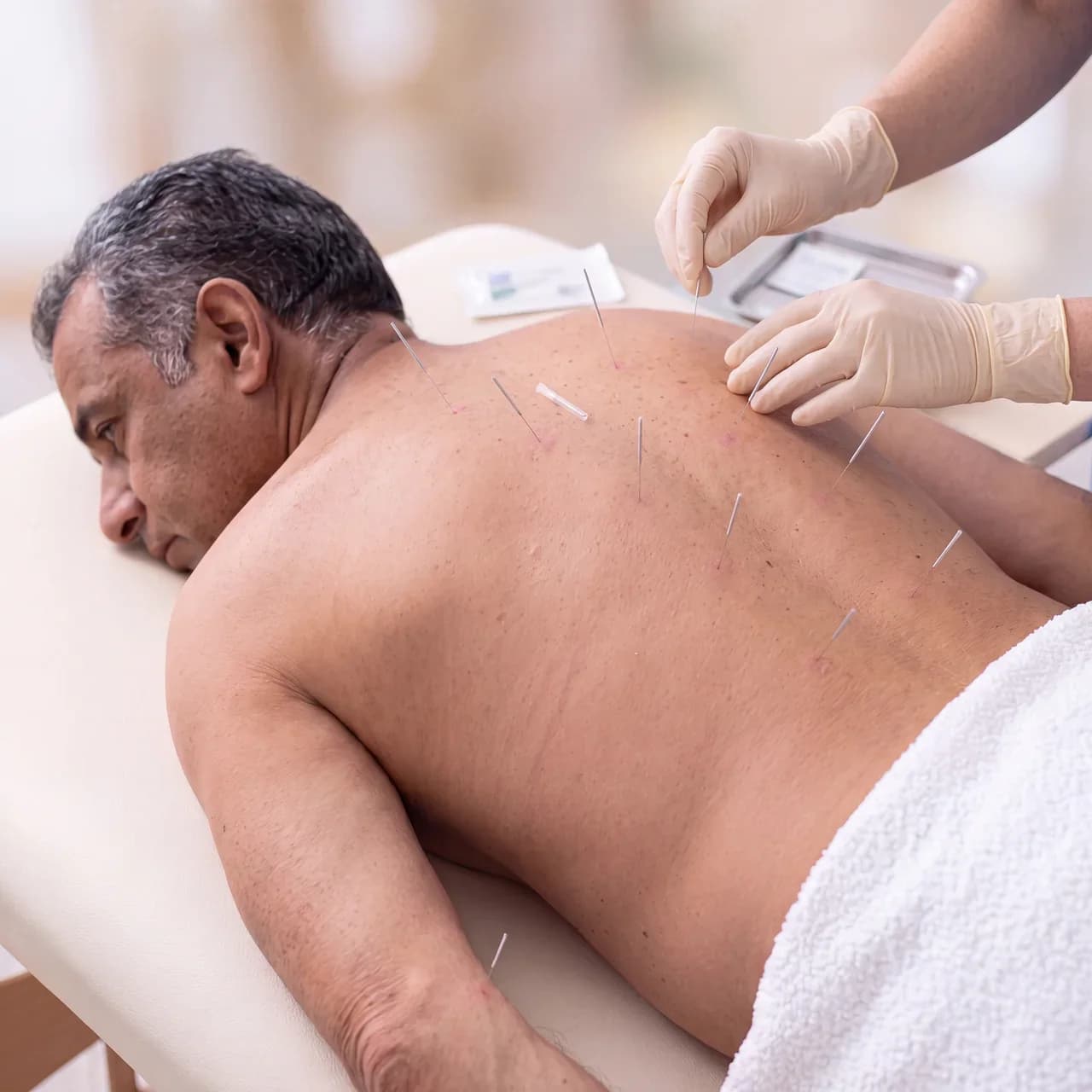 Dry Needling